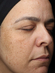 Image of face after using product